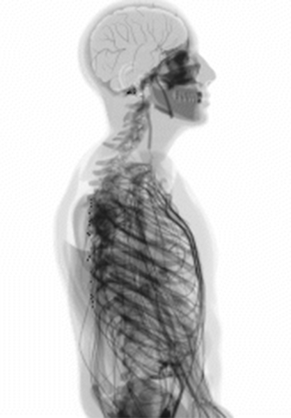 medical animation